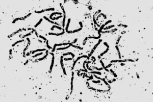 クロマツの染色体　2n=24（1967年撮影）